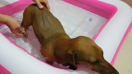 Physiotherapy After Spinal Surgery