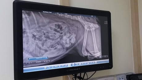 HUGE Bladder Stones!