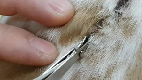 Removing Post-Surgical Staples <br>from Large Spinal Wound