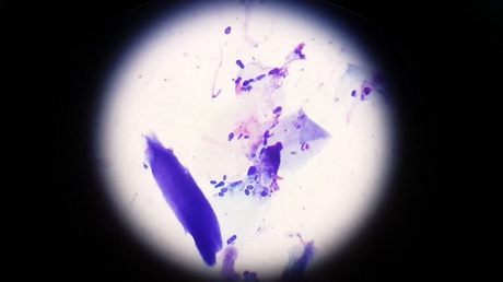 Microscopic View of Yeasty Tissue