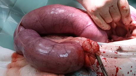 Uterine Infection (Pyometra) in an Unspayed Dog