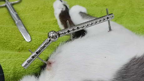 External Fixators and Their Workings