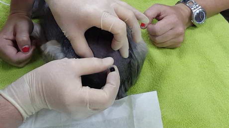 Epidural Anaesthesia