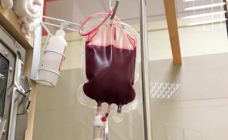 Blood Transfusions