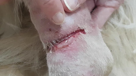 Home-made bandages can cause problems