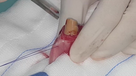 Eating the wrong things!!