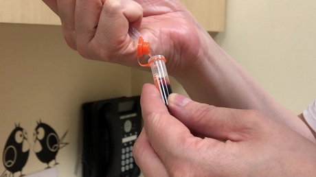 Pre-Anaesthetic Blood Tests