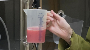 Pleural Effusion and a Thoracocentesis